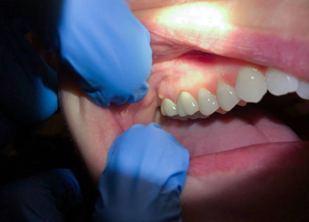 Best Mobile Emergency Dentist in Weatherford, OK